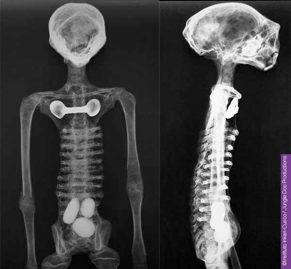 Radiographie de Josefina - Oeufs Radiographie de Josefina - Oeufs