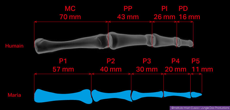 Comparaison à l’échelle d’un annulaire de main humaine (en haut) et du doigt intérieur de la main de Maria (en bas). MC : métacarpe – PP : phalange proximale – PI : phalange intermédiaire – PD : phalange distale P1...5 : phalanges 1 à 5