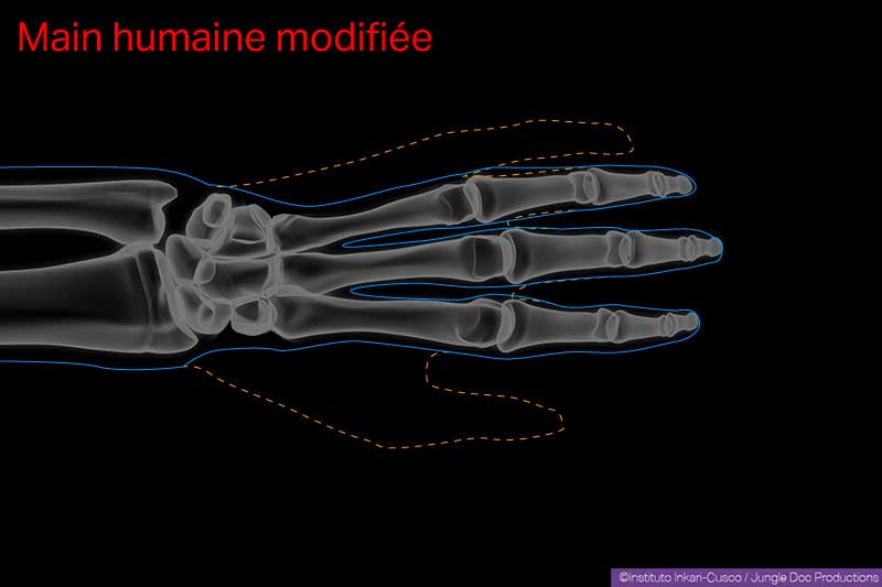 Main humaine modifiée. En pointillé orange, la forme extérieure de la « main originale ». En trait plein bleu, la forme extérieure de la « main modifiée ».