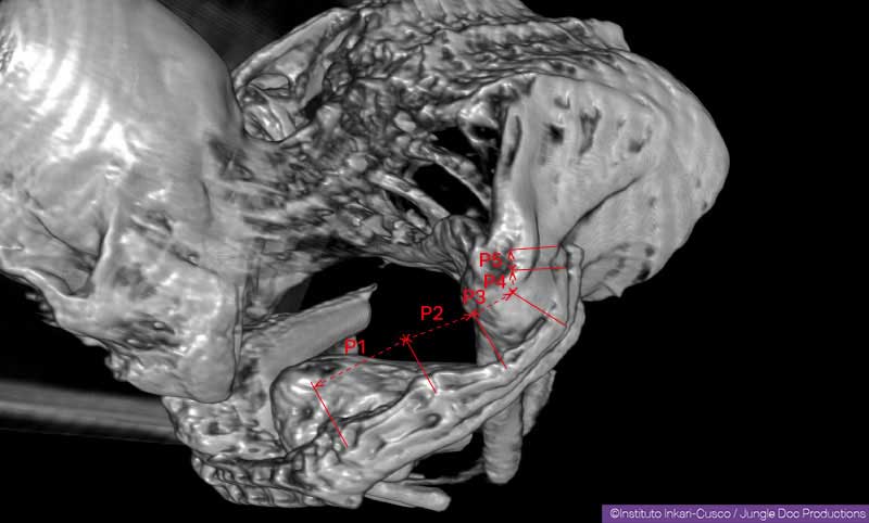 Imagen del escáner que muestra las 5 falanges (P1 a P5) de un dedo con una mano de María