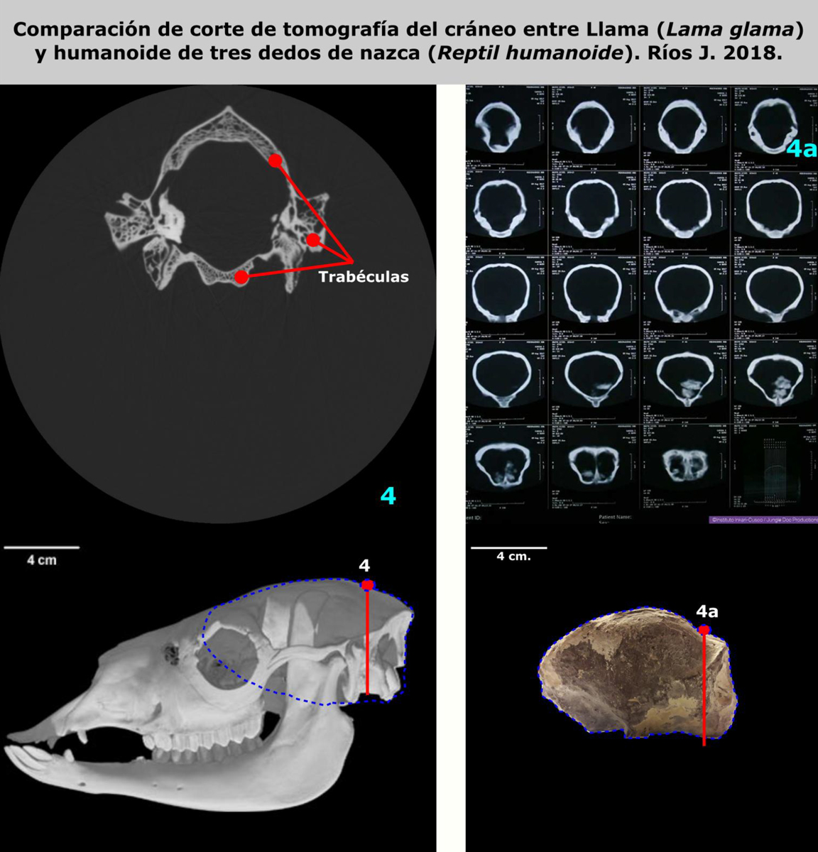 Comparaison de coupes tomographiques de crânes (images scanner) entre le Lama et l’humanoïde à trois doigts de Nasca Comparaison de coupes tomographiques de crânes (images scanner) entre le Lama et l’humanoïde à trois doigts de Nasca