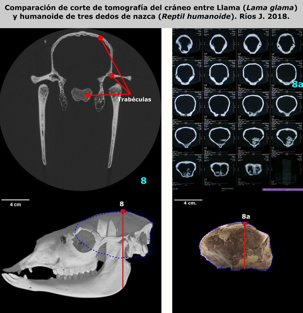 Comparison of tomographic sections of skulls (scanner images) between the Lama (Lama glama) and the three-fingered Nasca humanoid (Humanoid Reptile). Rios J. 2018