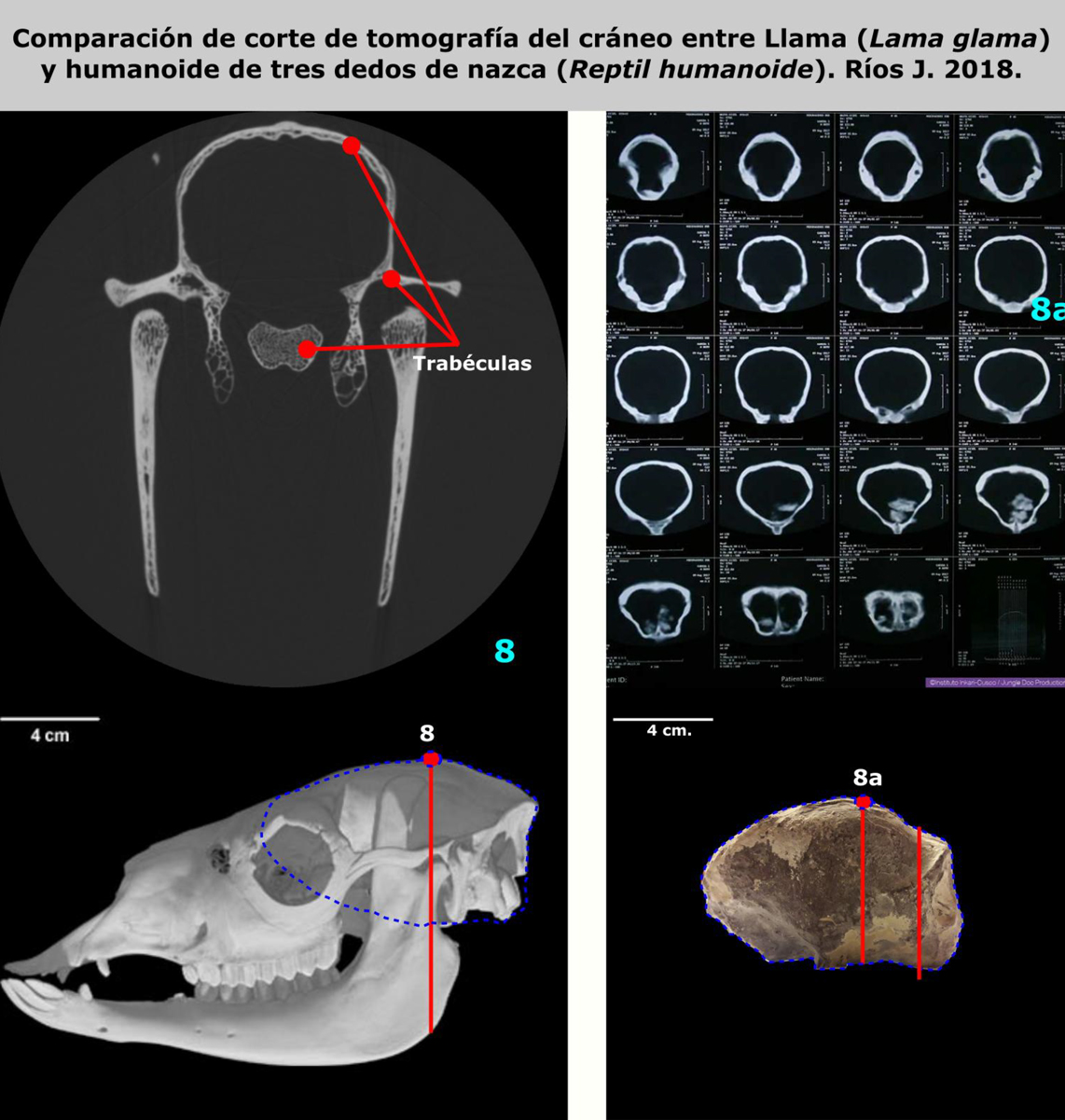 Comparaison de coupes tomographiques de crânes entre le Lama et l’humanoïde à trois doigts de Nasca Comparaison de coupes tomographiques de crânes entre le Lama et l’humanoïde à trois doigts de Nasca