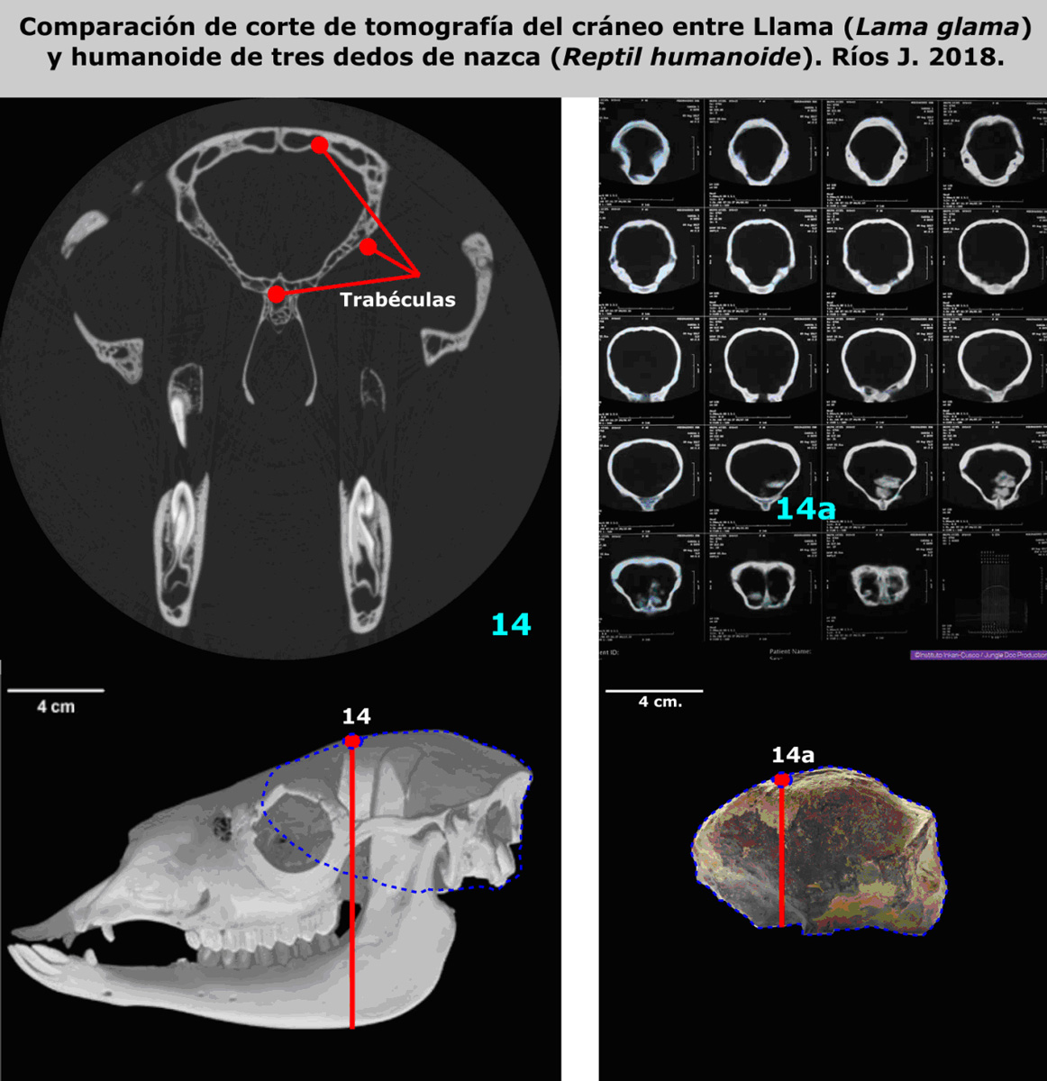 Comparison of tomographic sections of skulls (scanner images) between the Lama (Lama glama) and the three-fingered Nasca humanoid (Humanoid Reptile). Rios J. 2018