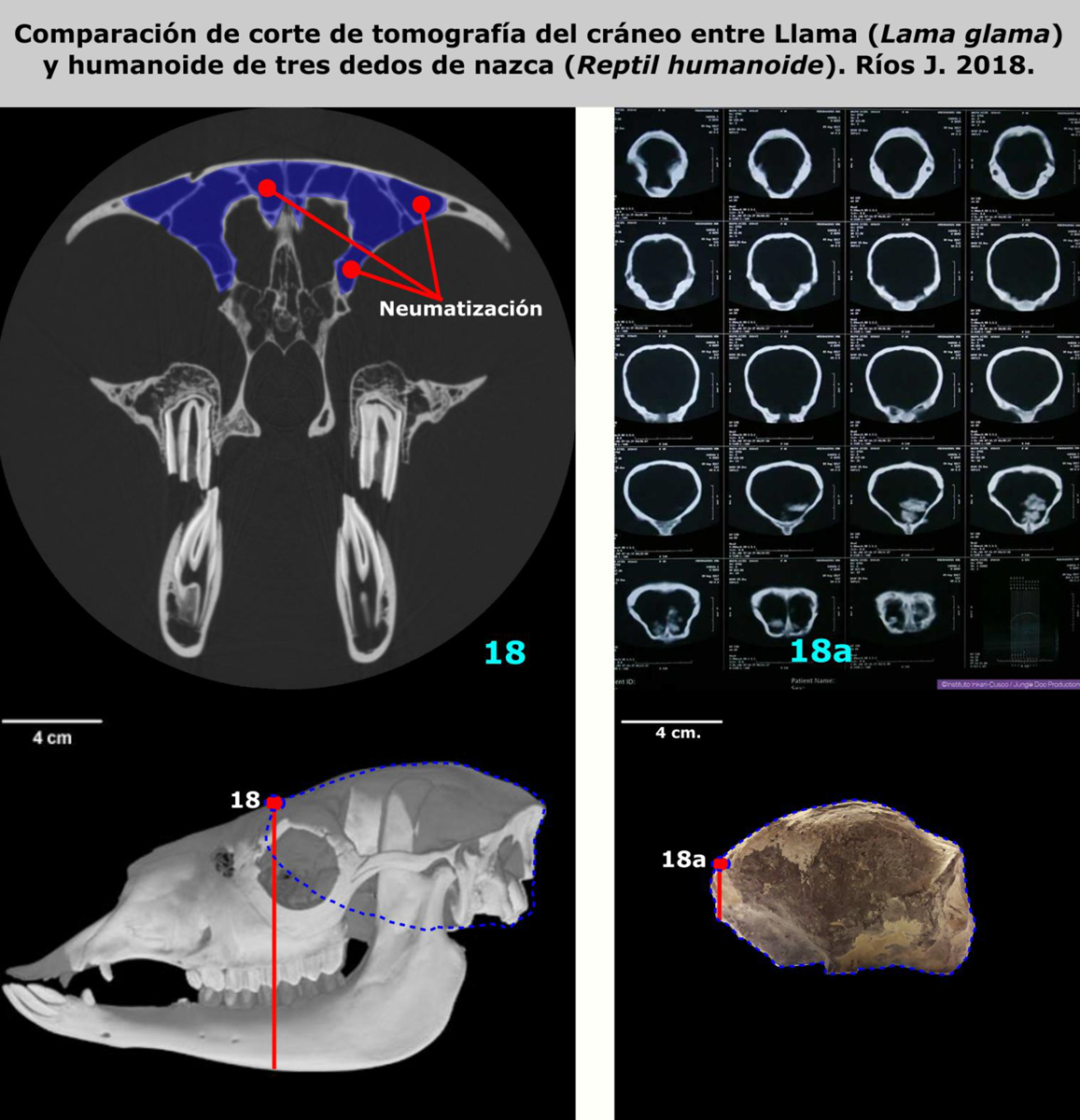 Comparison of tomographic sections of skulls (scanner images) between the Lama (Lama glama) and the three-fingered Nasca humanoid (Humanoid Reptile). Rios J. 2018