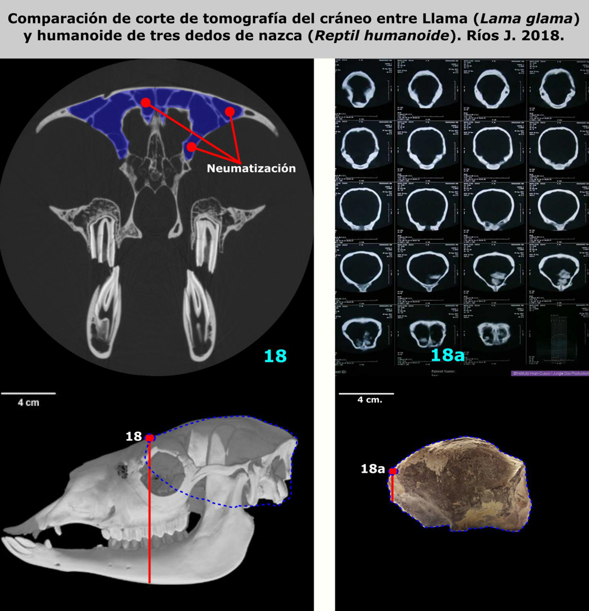 Comparaison de coupes tomographiques de crânes (images scanner) entre le Lama (Lama glama) et l’humanoïde à trois doigts de Nasca (Reptile Humanoïde). Comparaison de coupes tomographiques de crânes (images scanner) entre le Lama (Lama glama) et l’humanoïde à trois doigts de Nasca (Reptile Humanoïde).