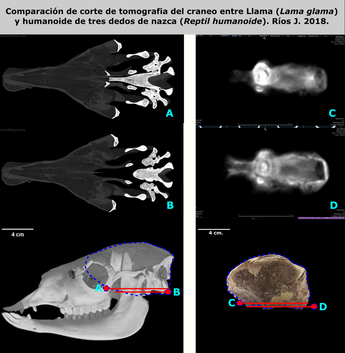 Comparison of tomographic sections of skulls (scanner images) between the Lama (Lama glama) and the three-fingered Nasca humanoid (Humanoid Reptile). Rios J. 2018