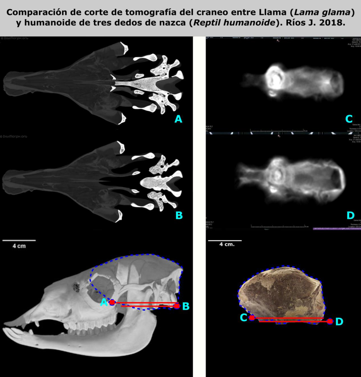 Comparación de secciones tomográficas de cráneos entre el lama y el humanoide de tres dedos de Nasca Comparación de secciones tomográficas de cráneos entre el lama y el humanoide de tres dedos de Nasca