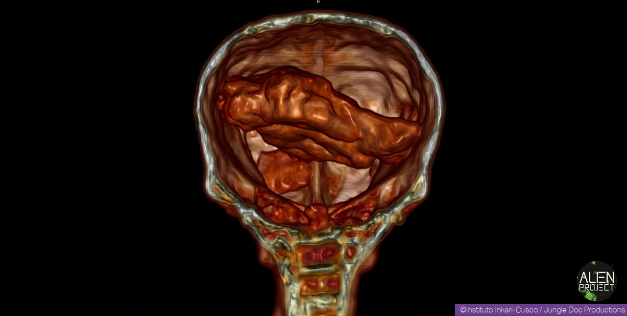 05-josefina-cerveau.jpg